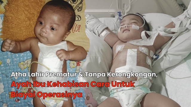 Bantu Atha Dengan Kelainan Langka Sejak Lahir - 22096