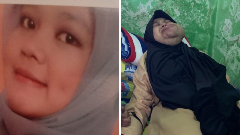 Menahan Sakit 7 Tahun Agar Putrinya Tetap Tersenyum - 16973