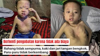 Kelainan Sejak Lahir, Bantu Reyhan Lanjutkan Pengobatan