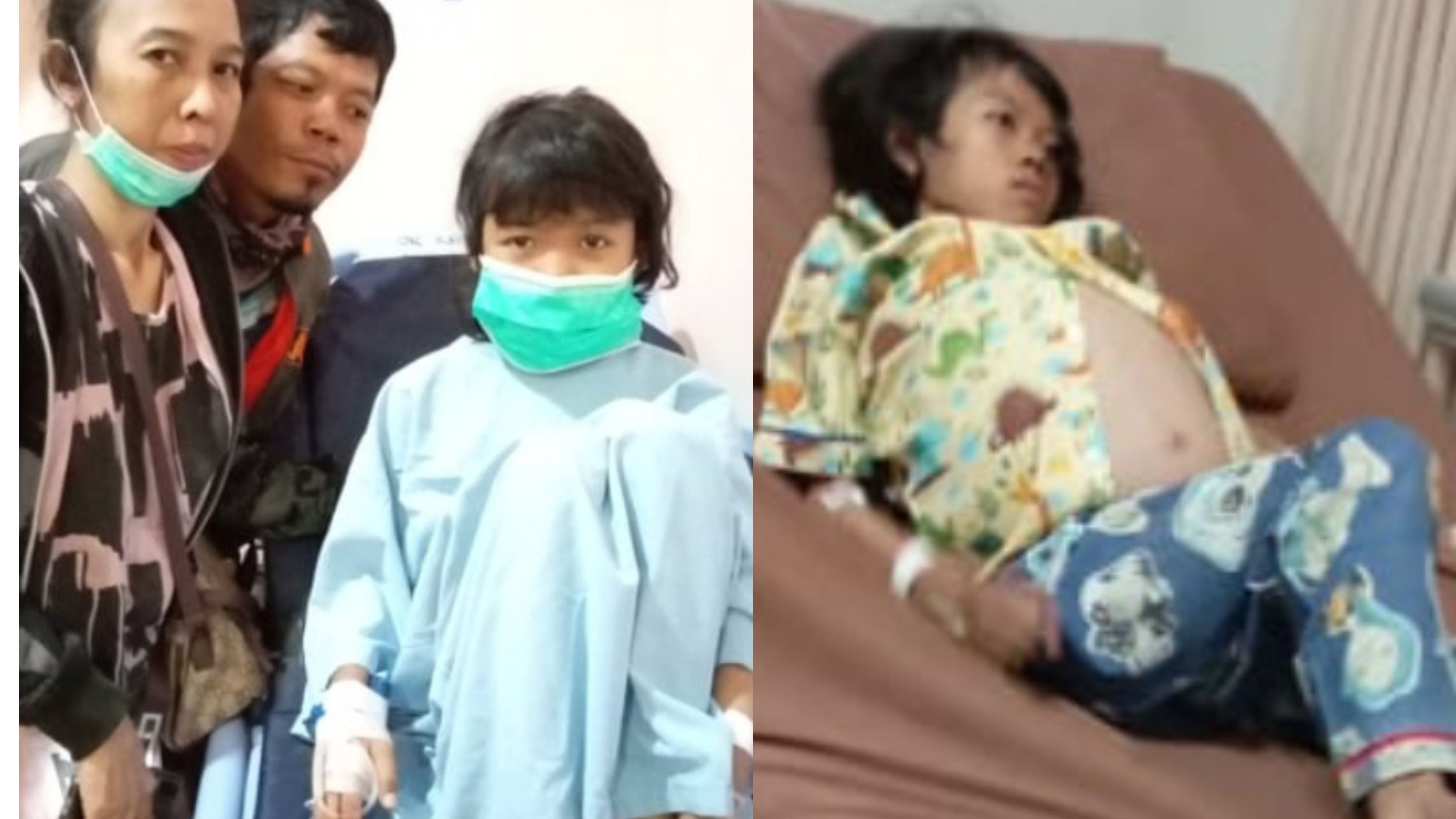 Bantu Adelia sembuh karena menderita Hisprung atau penyempitan usus - 14811