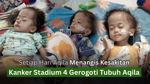 Selamatkan Aqila dari Kanker Stadium 4 - 22439
