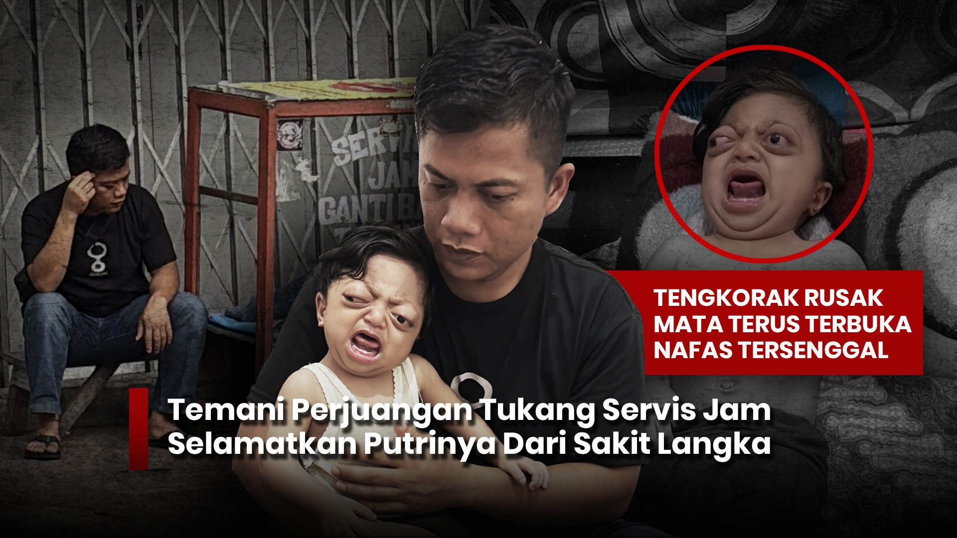 Bersamai Perjuangan Kinara Lawan Sesak dan Mata Terbuka