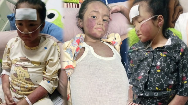 Bantu Nurissa Lawan Penyakit Langka HLH