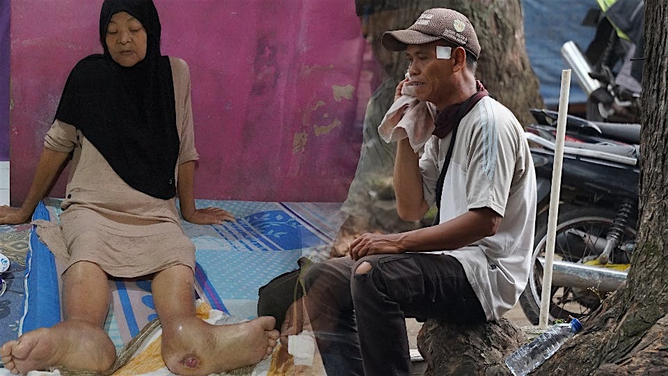 Bantu Perjuangan Pak Oman Selamatkan Bu Ai Dari Infeksi - 21551