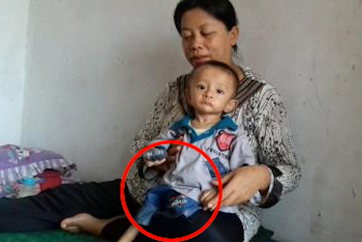 BANTU IQBAL BAYI YANG TERLAHIR TANPA ANUS DAN KAKI KIRI - 535