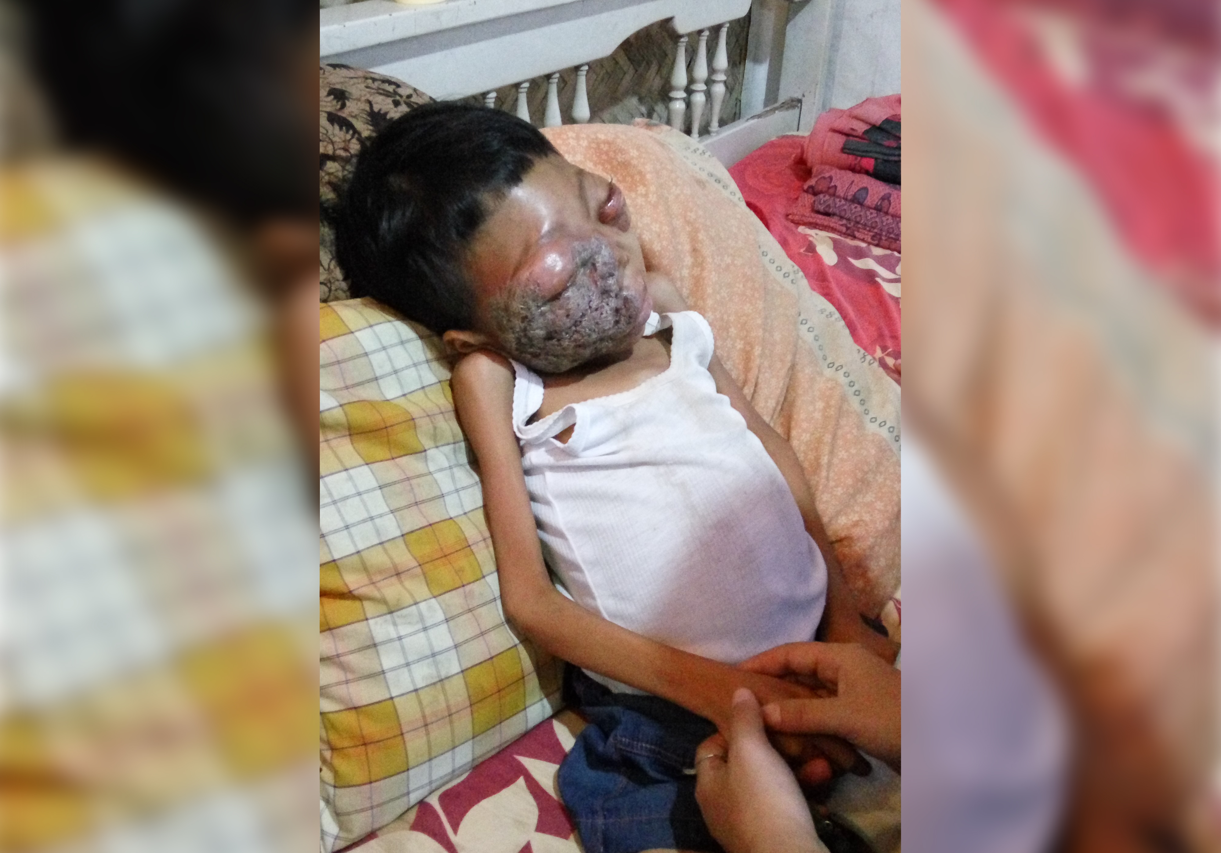 Bantu Gilang Sembuh dari Kanker Getah Bening - 601