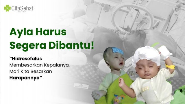 Ayla bayi mungil harus segera di bantu - 20486