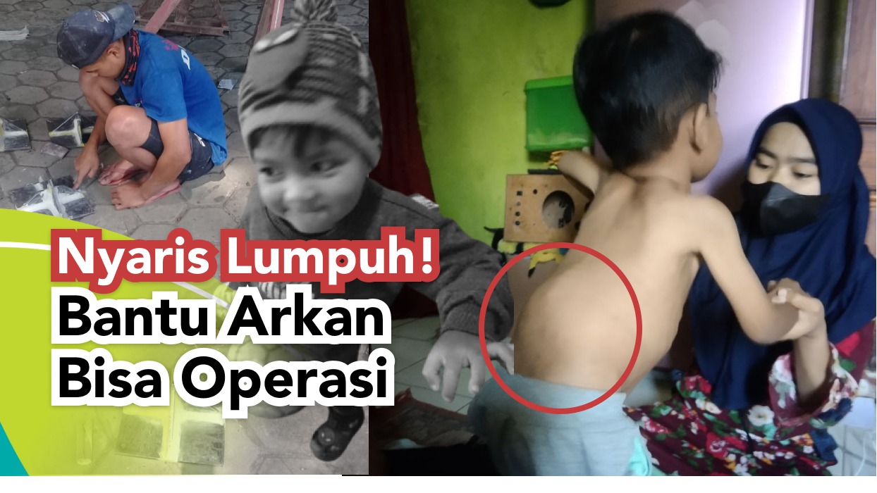 Nyaris Lumpuh!Bantu Arkan Bisa Operasi - 21065
