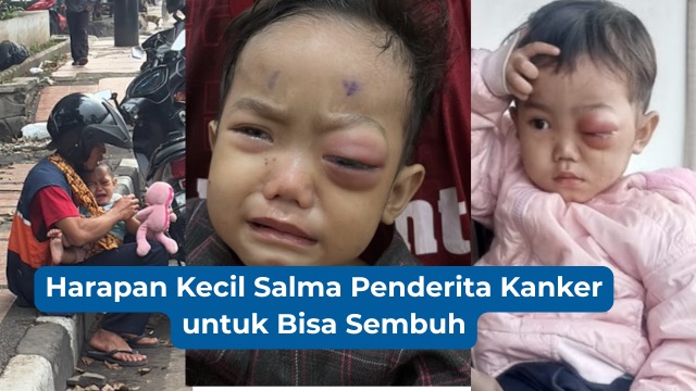 Harapan Kecil Salma Penderita Kanker untuk Bisa Sembuh - 22156