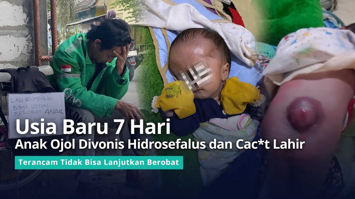 URGENT Bantu Ojol Segera Oprasi Anaknya - 21424