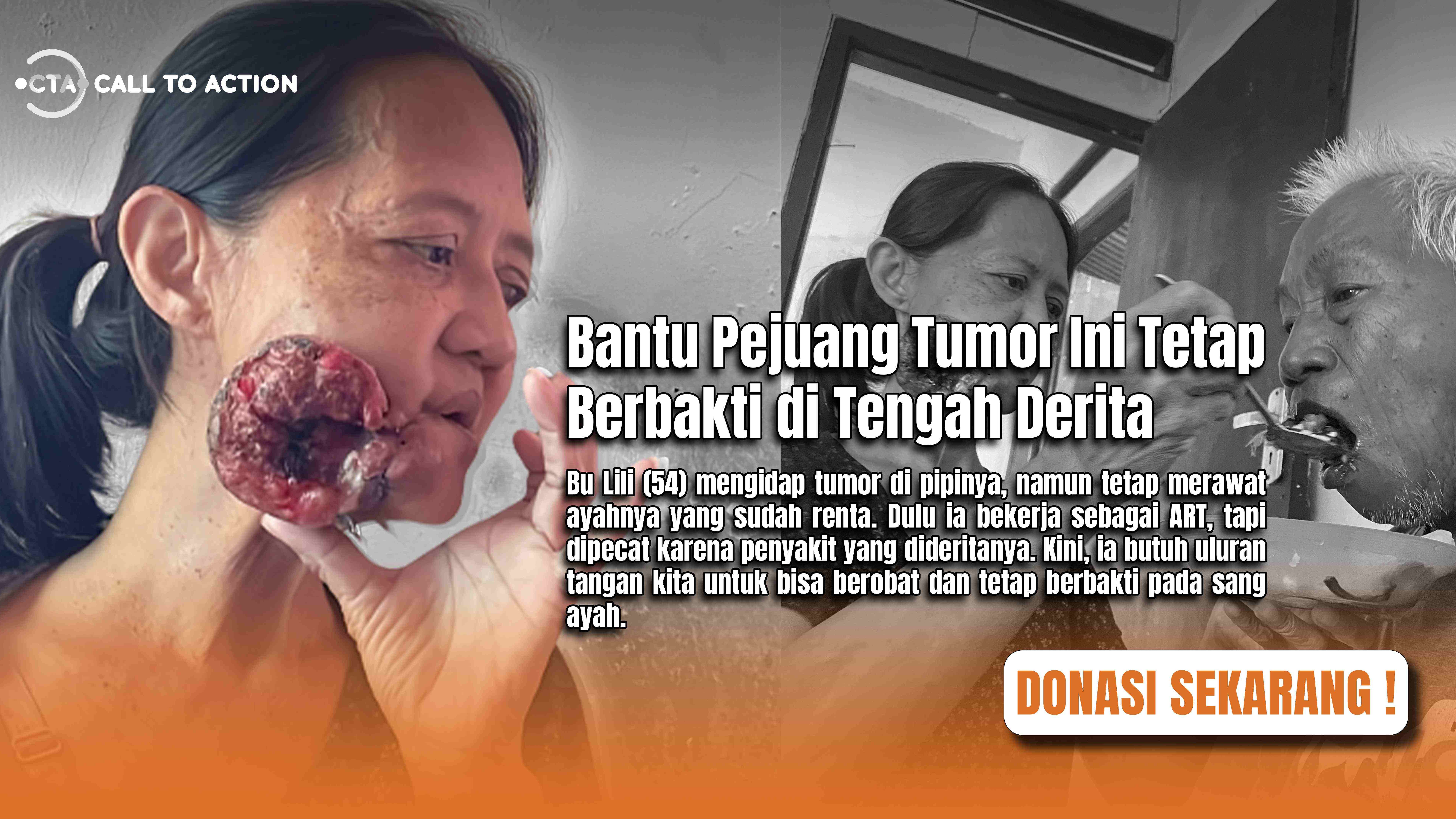 Bu Lili Bertahan Dalam Tumornya Demi Sang Ayah Tercinta - 21594