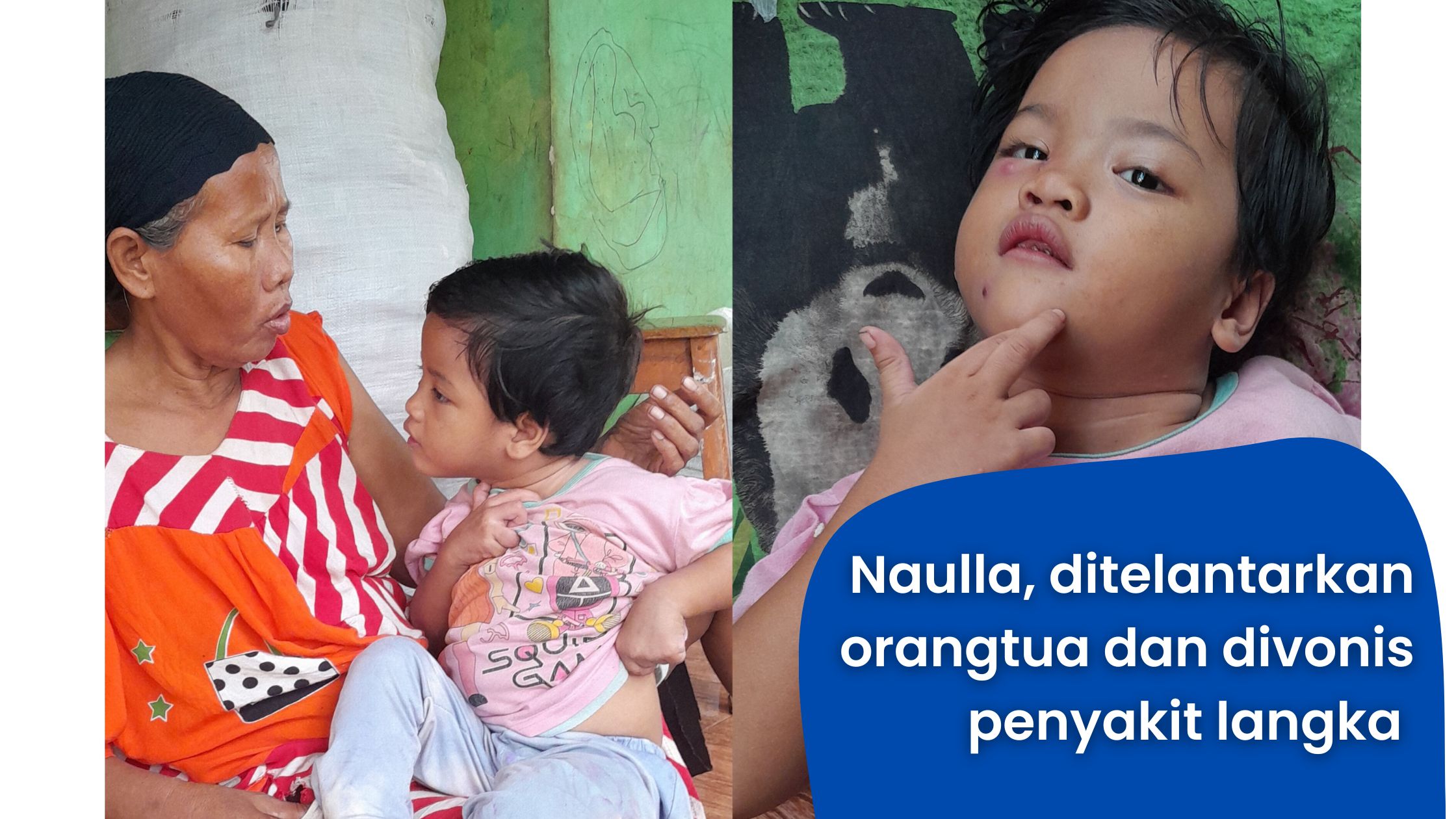 Perjuangan seorang nenek rawat cucunya yang sakit - 14694
