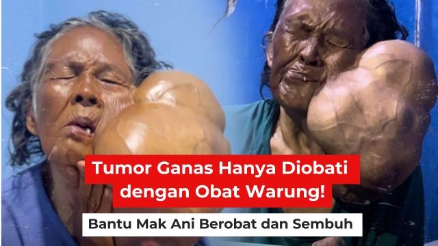 Ditinggal Suami Saat Tumor Parah dan Terancam Diusir - 22760