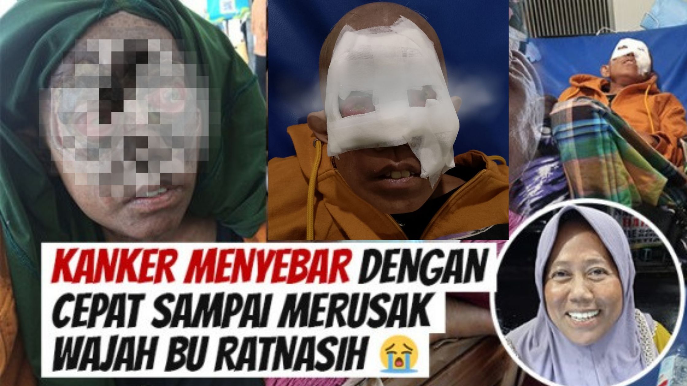 Tolong Bantu Bu Ratnasih Butuh Pengobatan Segera - 20530