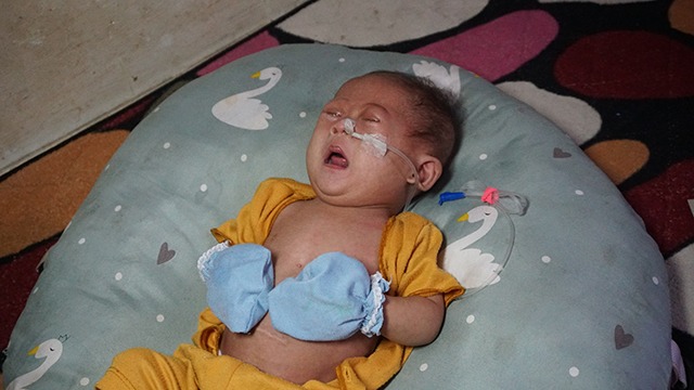 4 Penyakit Ancam Keselamatan Balita 5 bulan