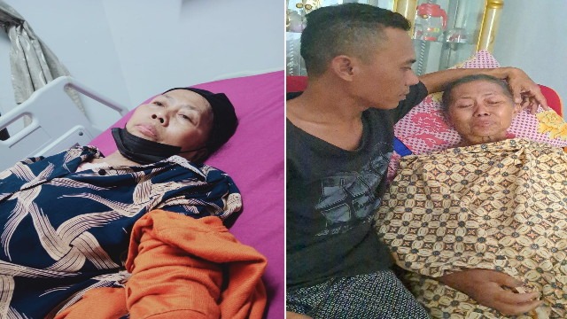 Penderitaan Ibu Kesih, Yang Mengidap Kanker Payudara - 14275