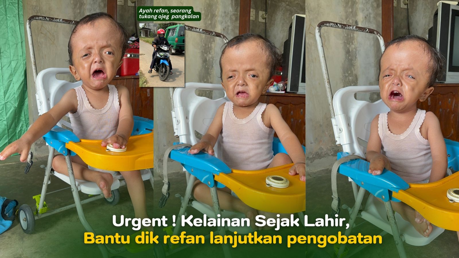 Urgent ! Kelainan Sejak Lahir Bantu dik refan Berobat - 22285