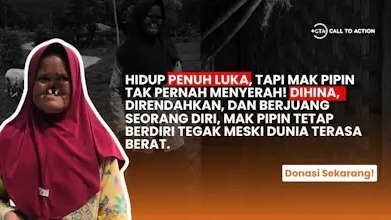 Bantu Mak Pipin Tak Punya Hidung Bertahan Dari Bullyan - 21661