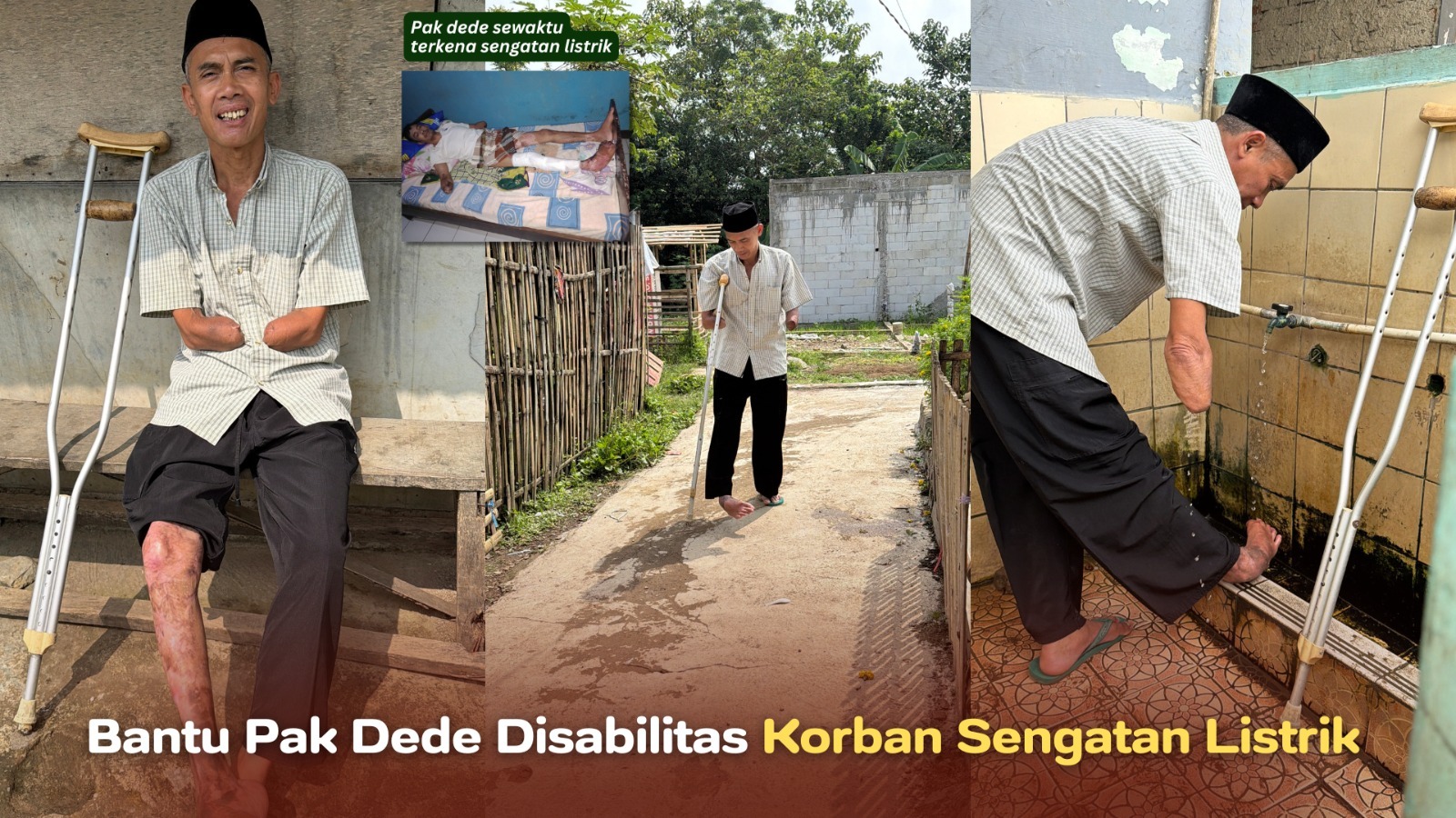 Bantu Pak Dede Disabilitas Korban Sengatan Listrik