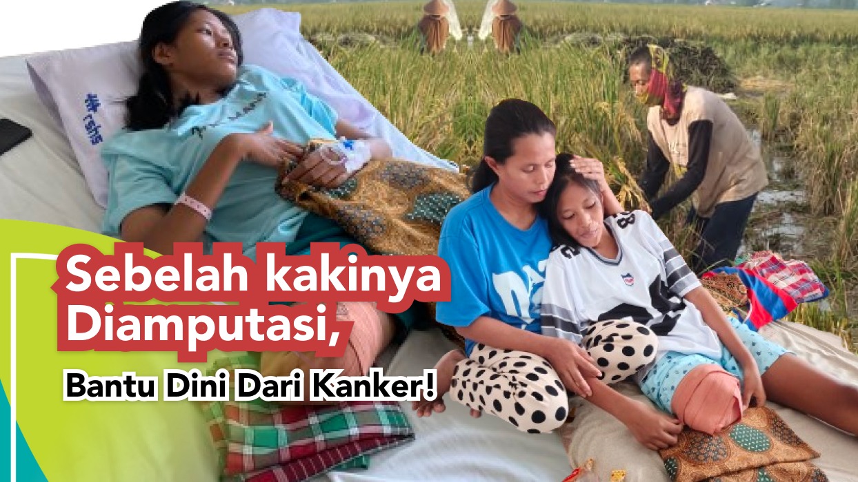 Kaki Diamputasi Bantu Dini Lawan Kanker Ganas - 20558