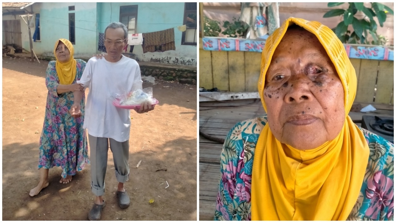 Butuh Berobat! Mata Mak Yati Rusak Digerogoti Penyakit - 17466