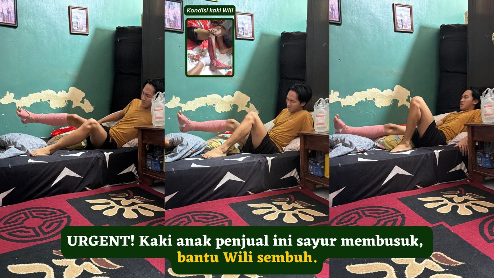 Kaki anak penjual sayur membusuk bantu Wili sembuh - 23076