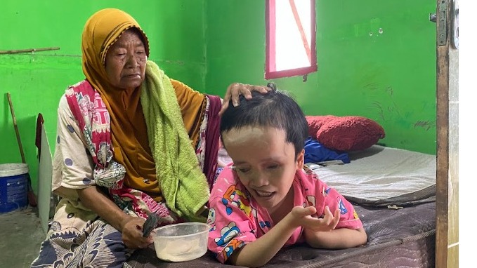 Sebatang Kara Hidupi Cucu 26th yang Hidrosefalus - 19929
