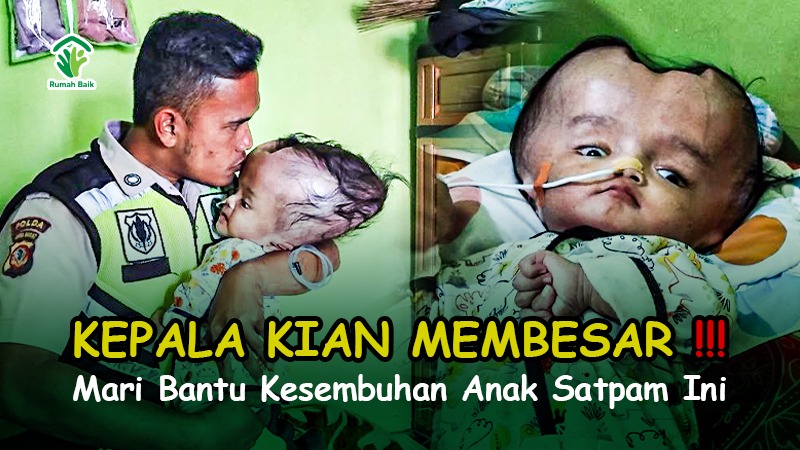 Kepala Membesar Ayah Hanya Satpam, Bantu Radit Operasi - 19467