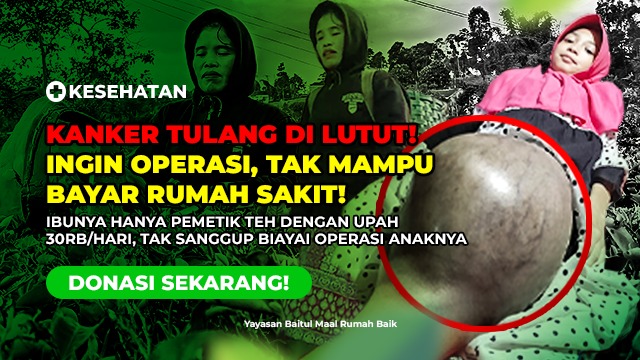 Bersama Kita Bantu Osi Lawan Kanker Tulang - 20789