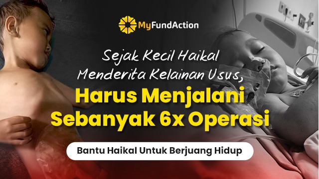 Selamatkan Haikal Melawan Penyakit Kelainan Usus Selama - 17710