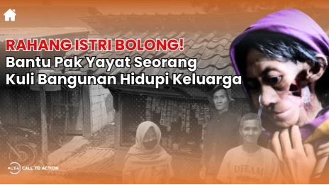 Tak Bisa Berobat Hingga Rahang Bolong! Bantu Bu Enok - 21835