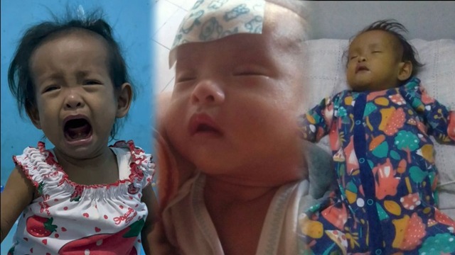 Selamatkan Mafaza! Tubuh Kecil Menderita Sakit Langka - 21529
