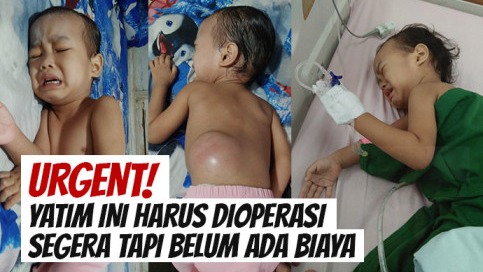 Idap TB Tulang Bantu Yatim Ini Sembuh Dari Sakitnya - 22256