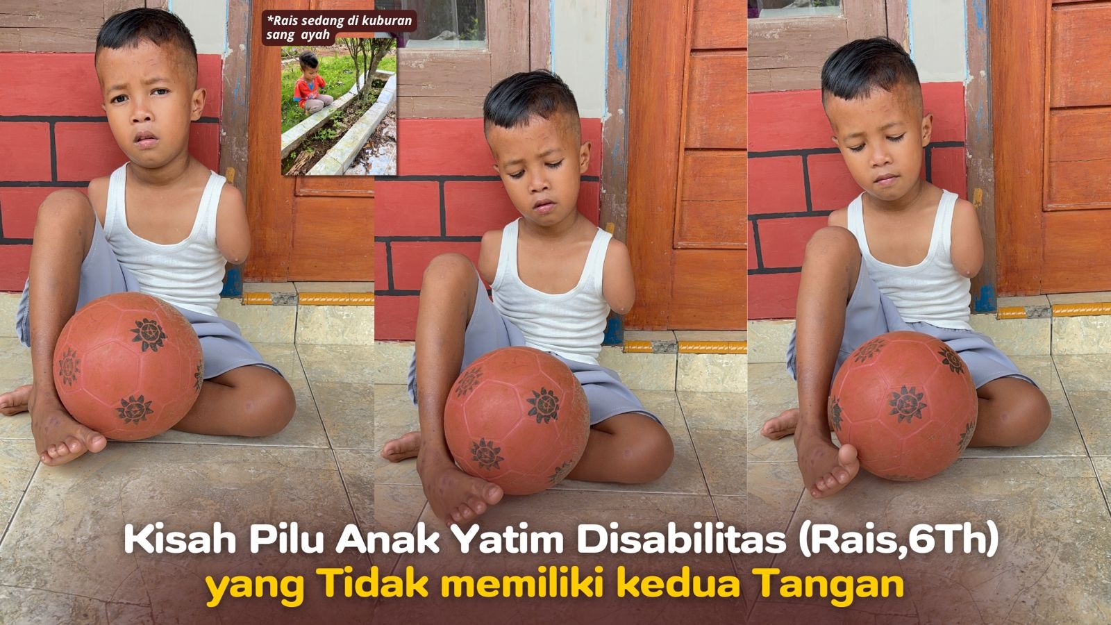Kisah Pilu Rais Anak Yatim Disabilitas Tanpa Tangan - 22283