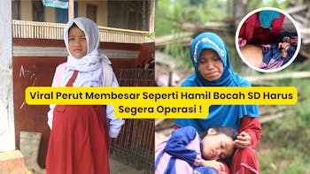 Perut Membesar Bocah SD Harus Segera Operasi