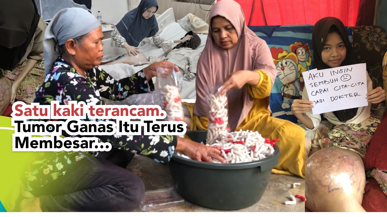 Bantu Calon Dokter Cilik Sembuh Dari Tumor Ganas - 23387