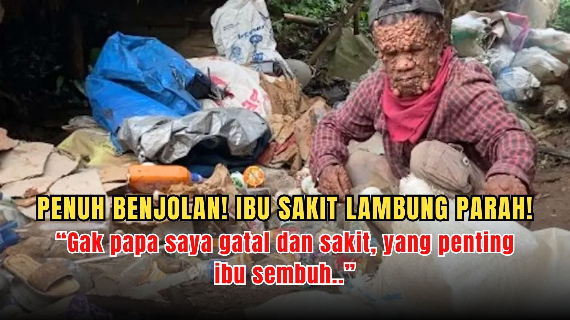 Penuh Benjolan! Bantu Bapak Rongsok Sembuhkan Ibunya