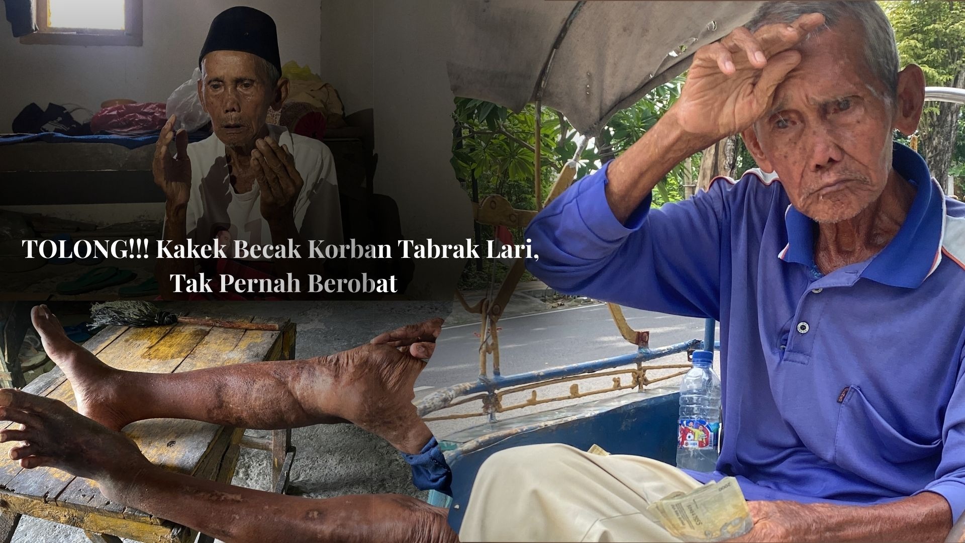 Tukang Becak Korban Tabrak Lari Tak Pernah Berobat - 21780