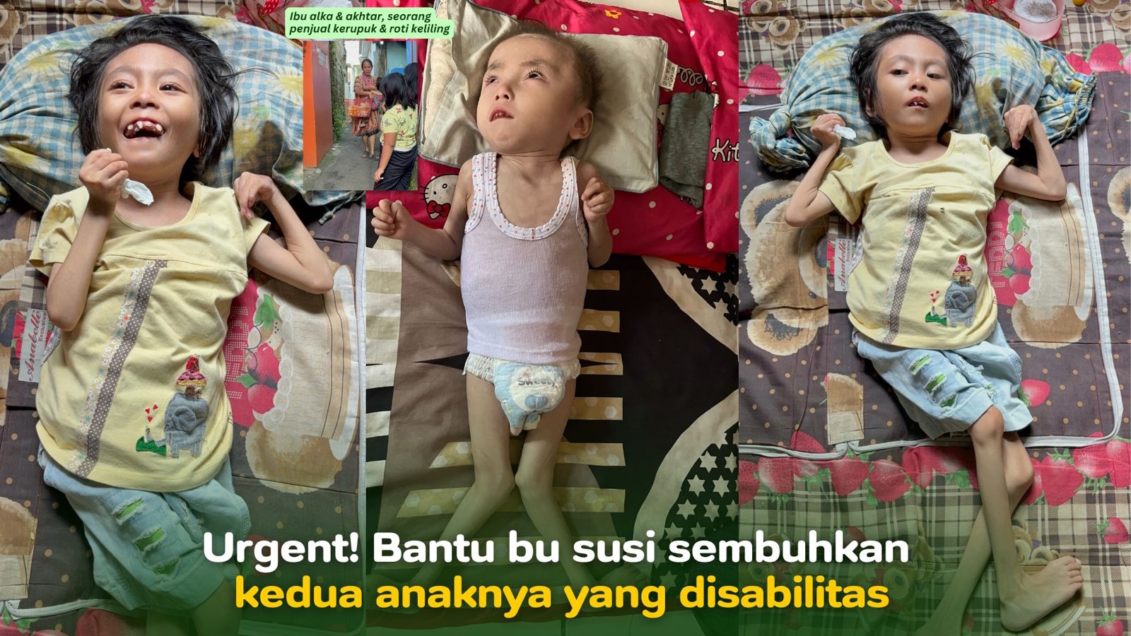 Bantu bu susi sembuhkan kedua anaknya yang disabilitas - 21385