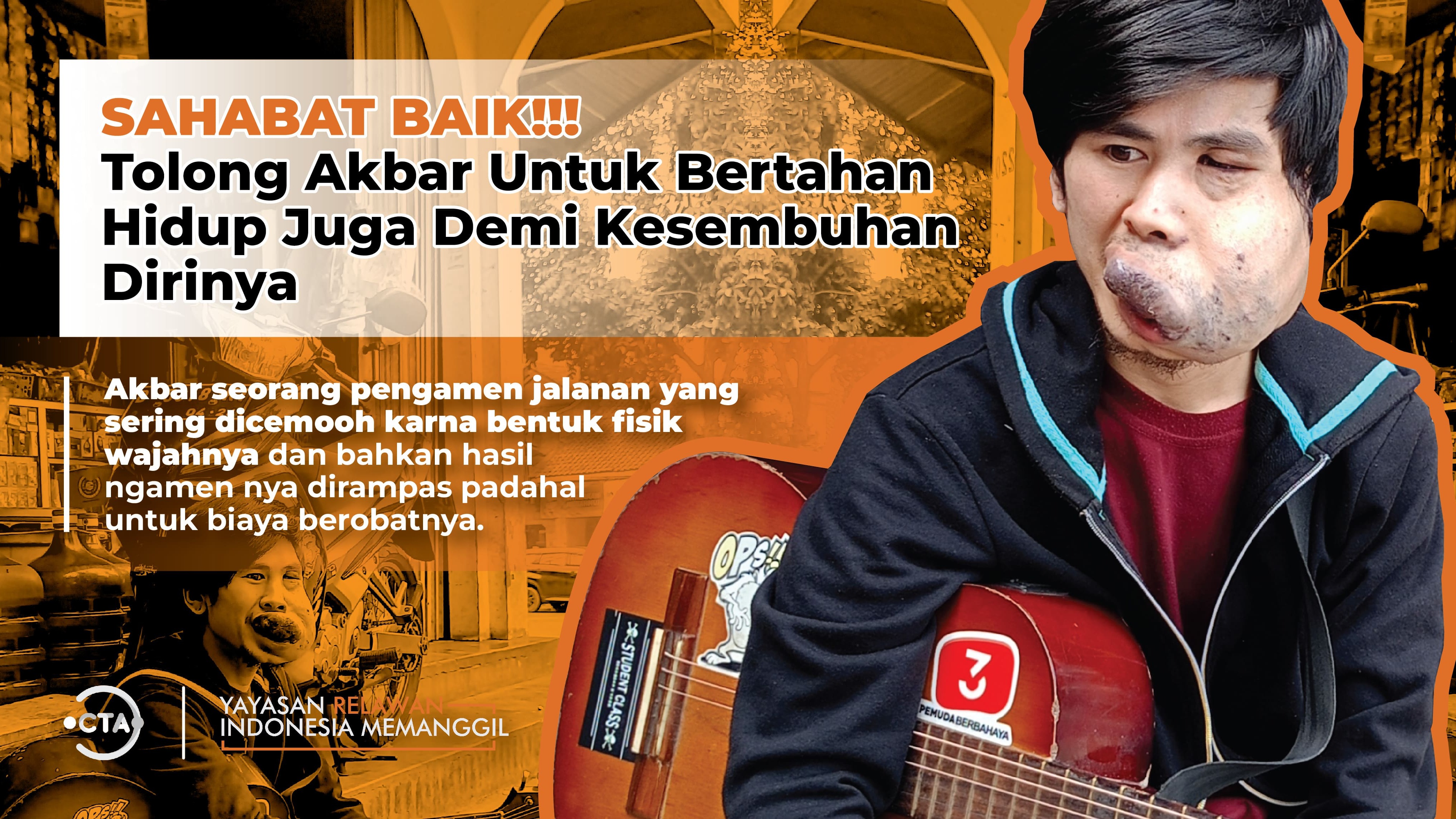 Bantu Akbar Pejuang Jalanan Tuk Lanjutkan Hidup - 19255