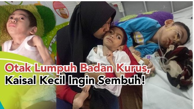 otak lumpuh badan kurus Kaisal Kecil ingin sembuh - 22004