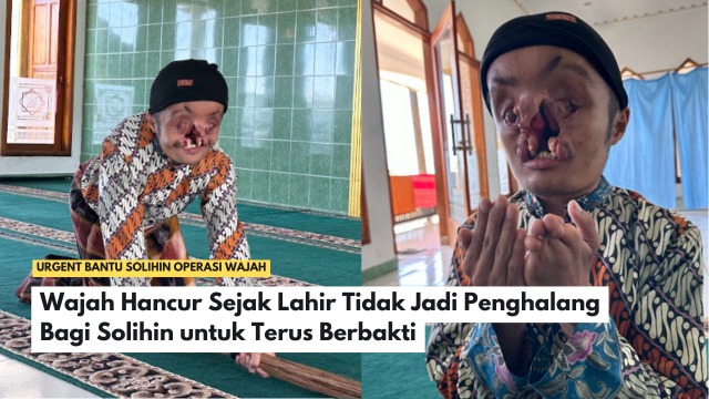 Wajah Hancur Tak Jadi Penghalang Solihin Tetap Berbakti - 22297