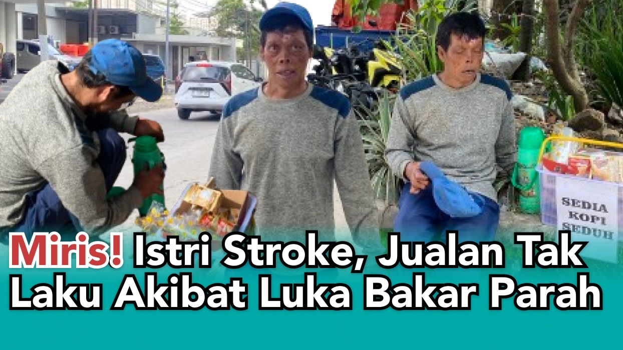 Jualan Tak Laku Akibat Luka Bakar Parah, Bantu Berdayakan Pak Lili - 20280