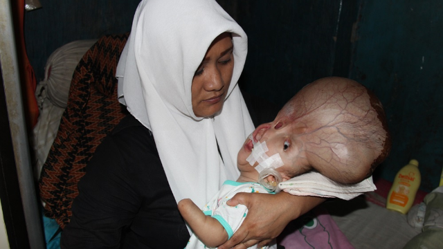BisaSembuh - Donasi untuk Biaya Pengobatan - 8479