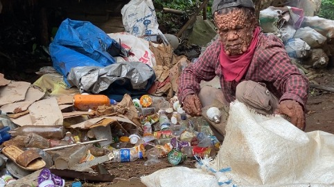 Bantu Mang Ade Berjuang Rawat Ibu - 20873