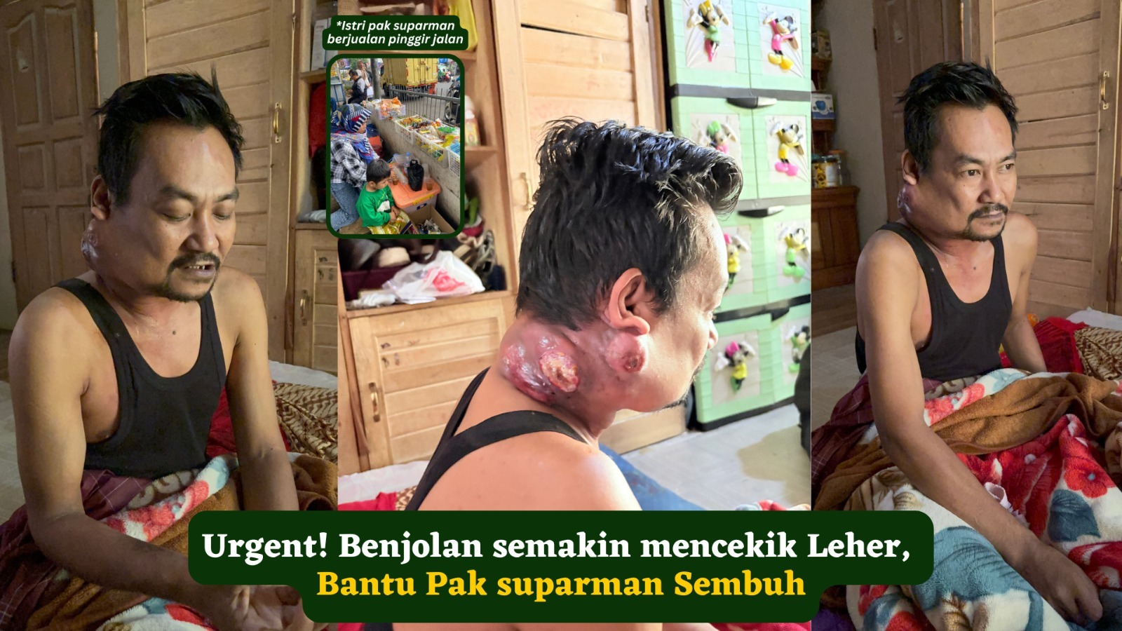 Benjolan mencekik Leher Bantu Pak suparman Sembuh - 21822