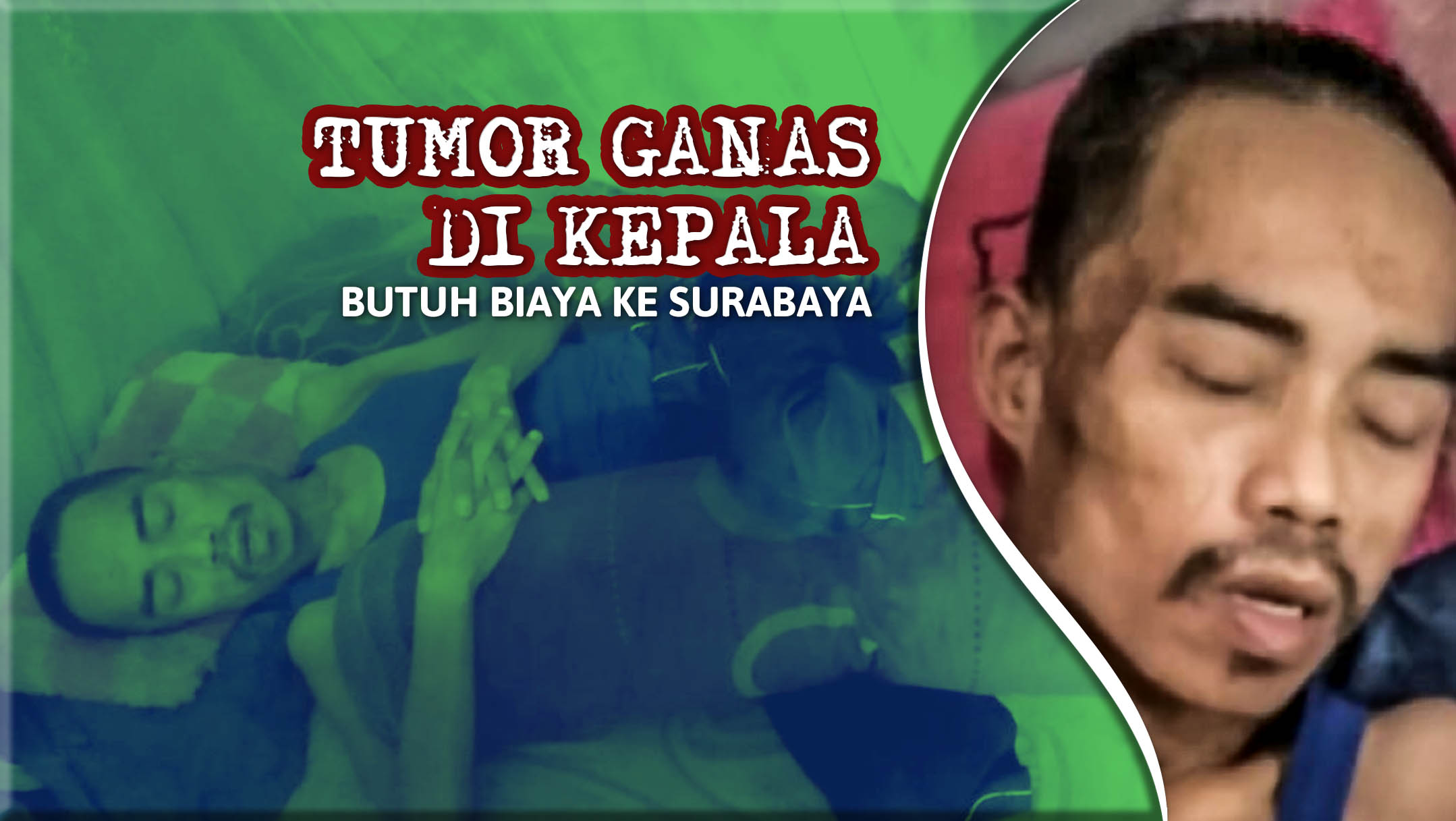 TUMOR GANAS DI KEPALA, BUTUH BIAYA KE SURABAYA - 5816