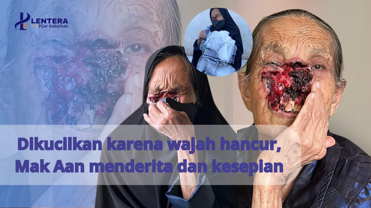 Perjuangan Mak Aan Dibalik Wajah Yang Terguras - 22923