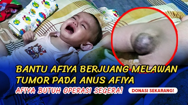 Tomor Semakin Membesar Afiya Butuh Oprasi Segera - 18482