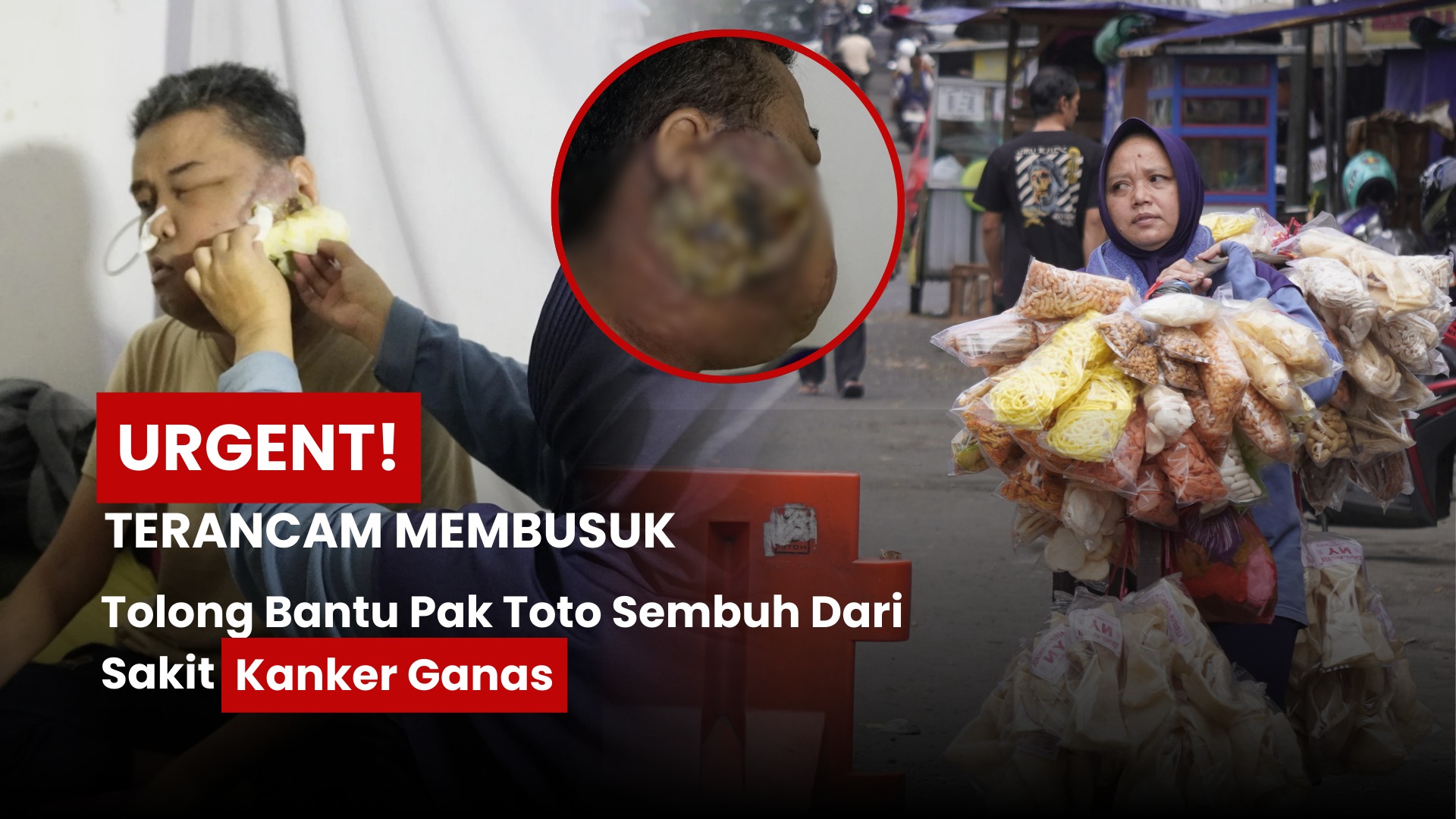 Tolong Bantu Pak Toto Sembuh Dari Sakit Kanker